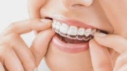 The Science Behind Invisalign