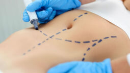 The Future of Body Contouring: Innovations in Tummy Tucks