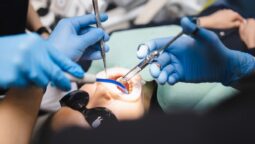 The Role Of Preventive Dentistry In Protecting Against Oral Cancer